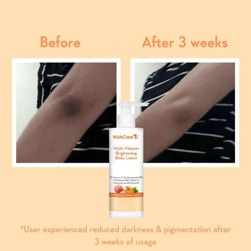 WishCare Multi Vitamin Brightening Body Lotion 200ml