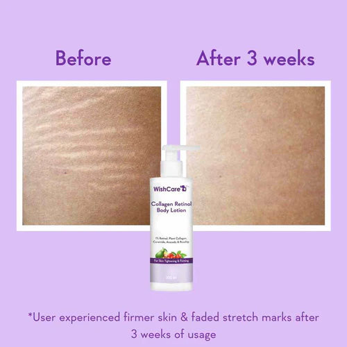 WishCare Collagen 1% Retinol Body Lotion | 200ml