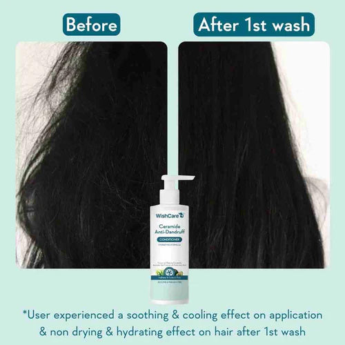 WishCare Ceramide Anti-Dandruff Conditioner 200ml