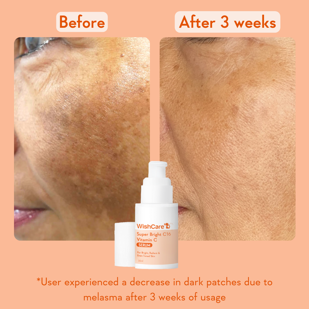Super Bright Vitamin C16 Serum