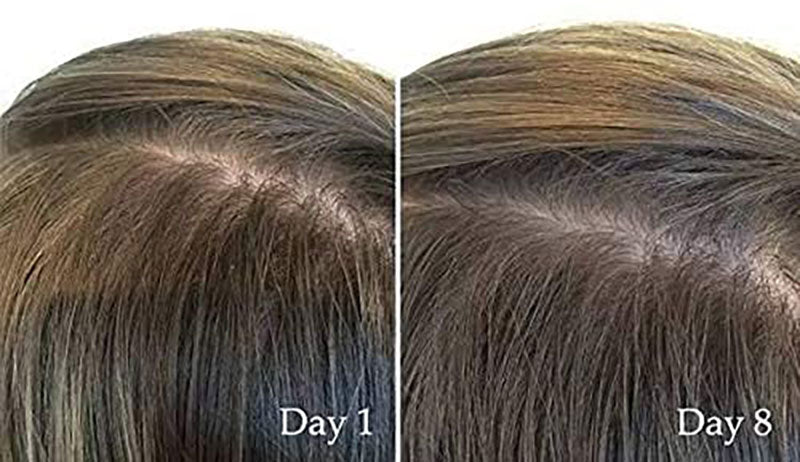 The Ordinary Multi-Peptide Serum for Hair Density 30ML