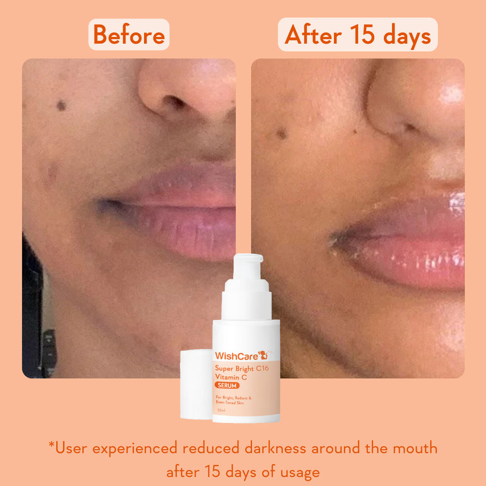 Super Bright Vitamin C16 Serum