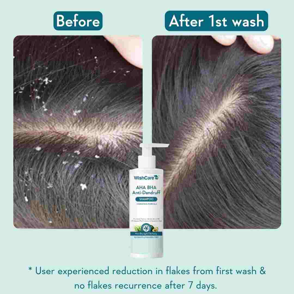 WishCare AHA BHA Anti-Dandruff Shampoo