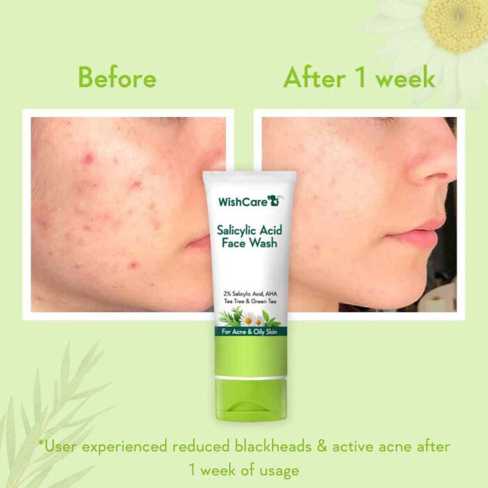 WishCare 2% Salicylic Acid Face Wash | 100ml