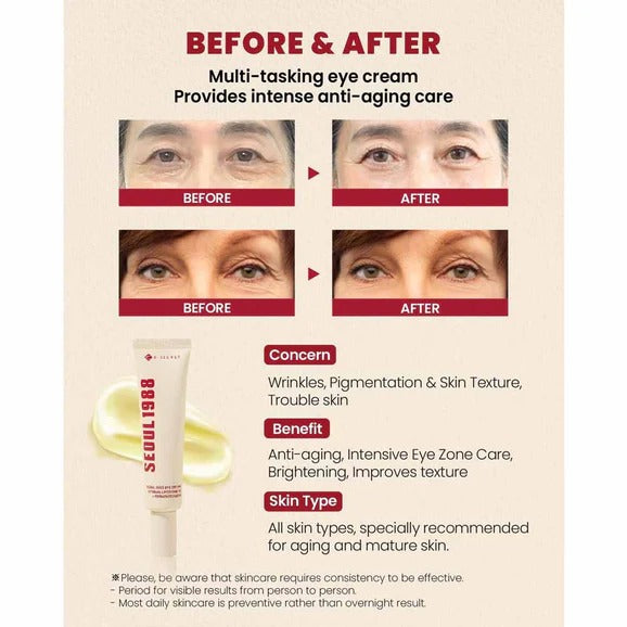 K-SECRET SEOUL 1988 Eye Cream : Retinal Liposome 4% + Fermented Bean